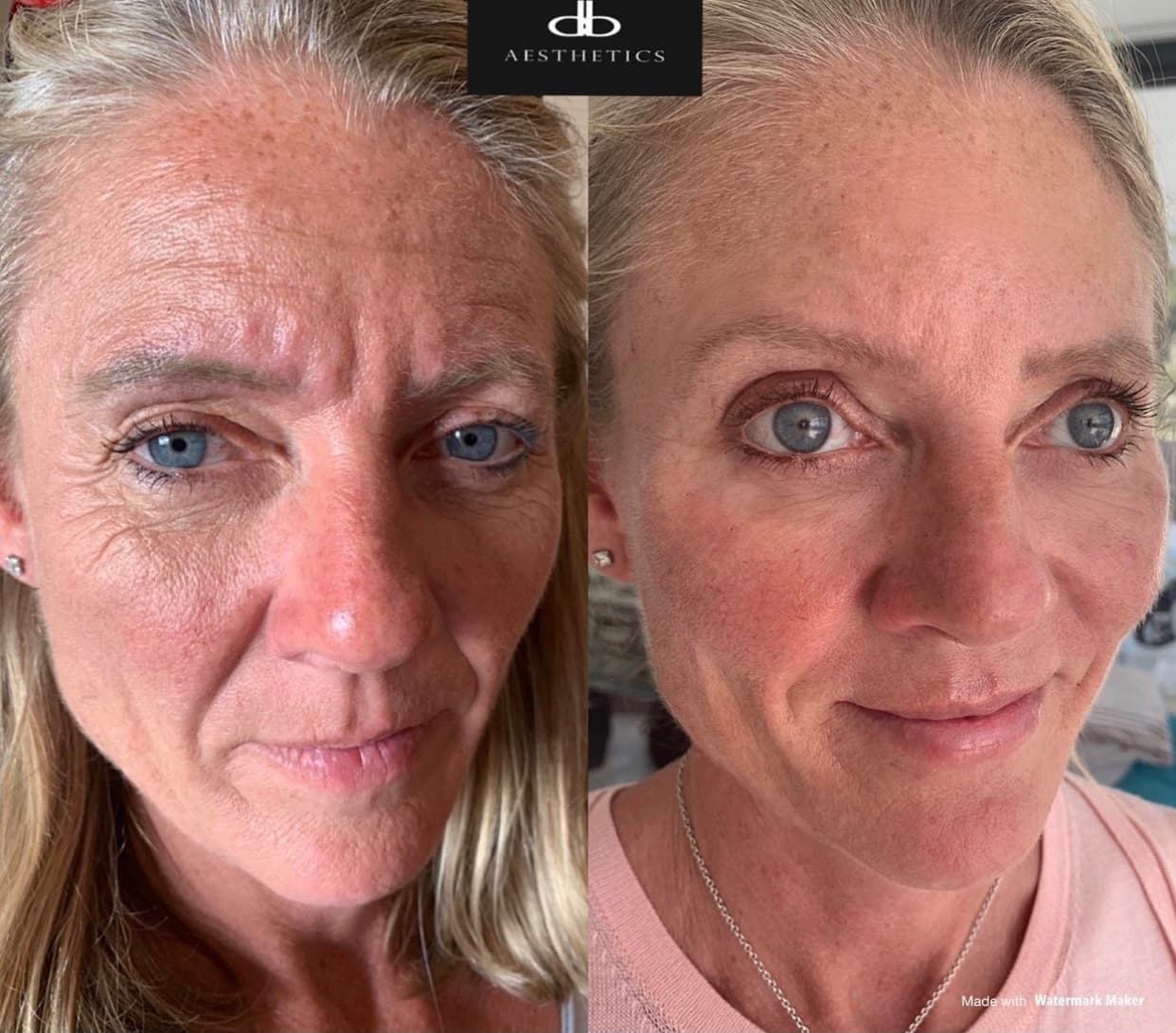 "Mummy Make-Over" Package