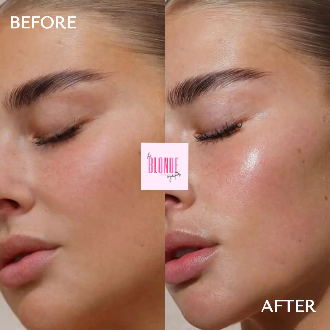 Skinboosters
